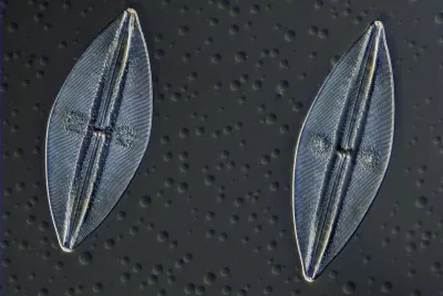 BRESSER MIKROCAMII 20 MP 1“ MIKROSKOPKAMERA