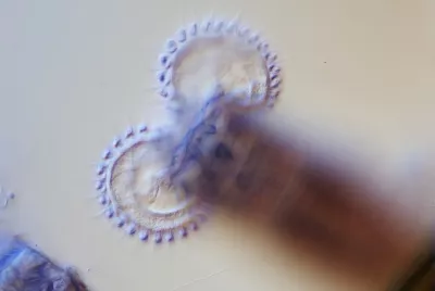 BRESSER MIKROCAMII 20 MP 1“ MIKROSKOPKAMERA